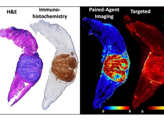 Cancer Center investigators designed a molecular imaging process that can visualize the entire region of a tumor and provide higher-contrast images in less time than other imaging techniques.