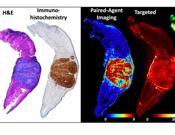 Cancer Center investigators designed a molecular imaging process that can visualize the entire region of a tumor and provide higher-contrast images in less time than other imaging techniques.