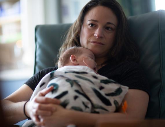A woman holds a sleeping infant against her chest. In the baby’s nose is a nasogastric tube.