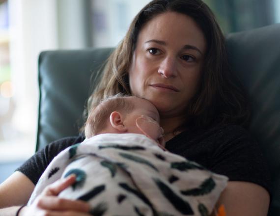 A woman holds a sleeping infant against her chest. In the baby’s nose is a nasogastric tube.