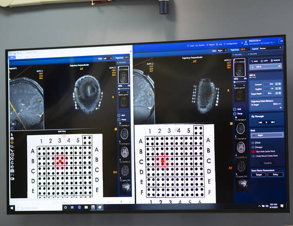 screens with brain CT